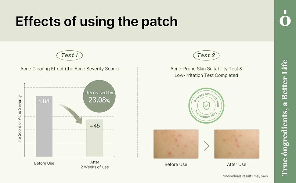 Ongredients AC Balancing PDRN Shot Patch 9ea